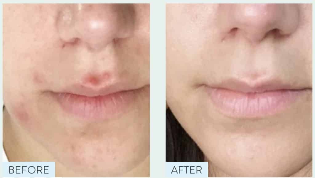 Proven Skincare Review - Must Read This Before Buying Proven Skincare Review - Must Read This Before Buying